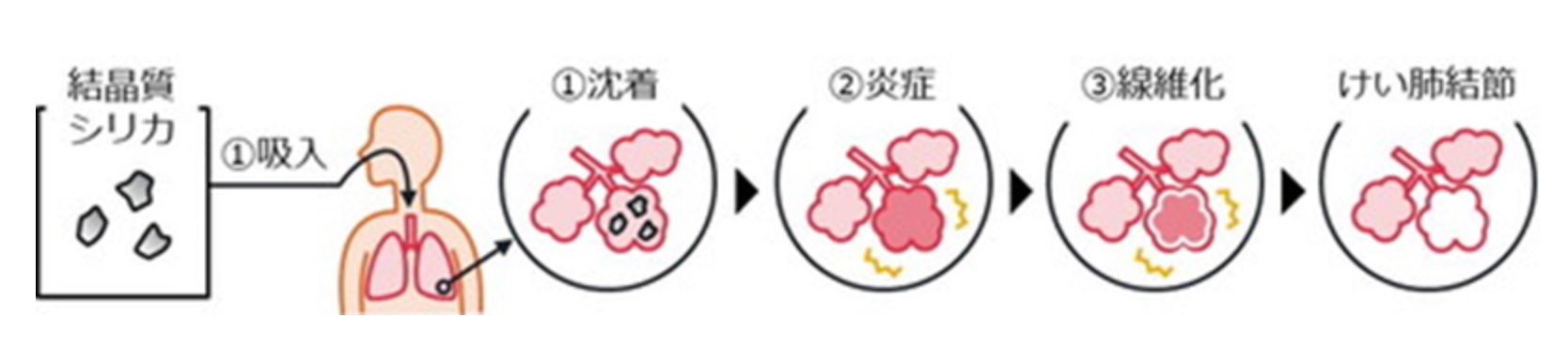 産業材料としての珪藻土とは、わかりやすく解説